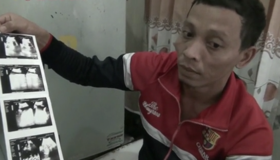 Dünya onları konuşuyor! İki yüzle doğdular  - Resim: 3