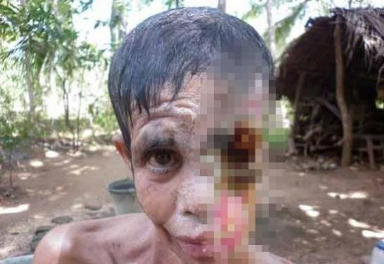 Et yiyen virüs kadının yüzünü yedi - Resim: 4