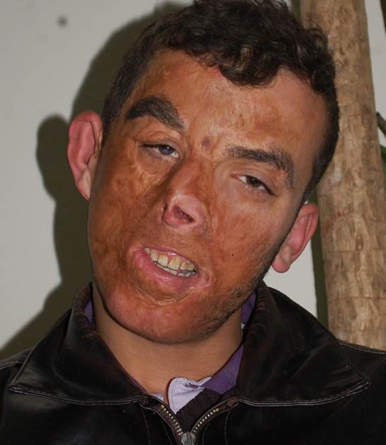 Türkiye'de bir ilk gerçekleşti - Resim: 3