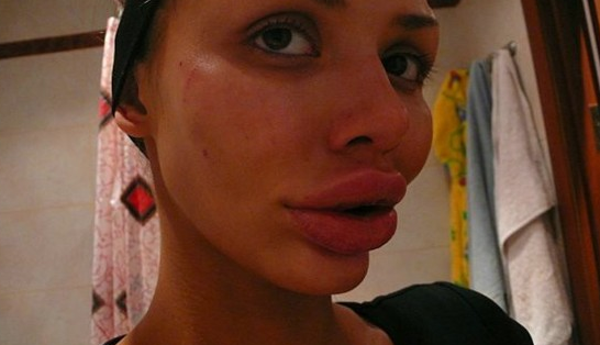 Güzelleşmek uğruna ördekleşen insanlar - Resim: 1