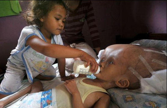 Bu çocuğun kafası sürekli büyüyor - Resim: 1