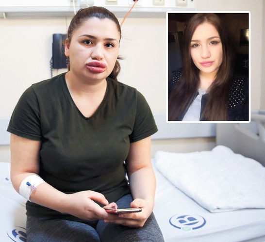 Silikon yaptırmak istemişti hemşire Merve Keleş ilk kez konuştu - Resim: 2