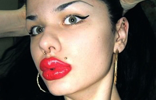 100 operasyonla bu hale geldi - Resim: 3