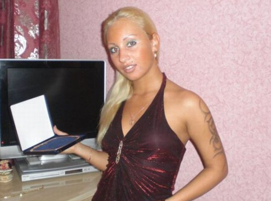 Botoksla gelen korkunç değişim! - Resim: 4