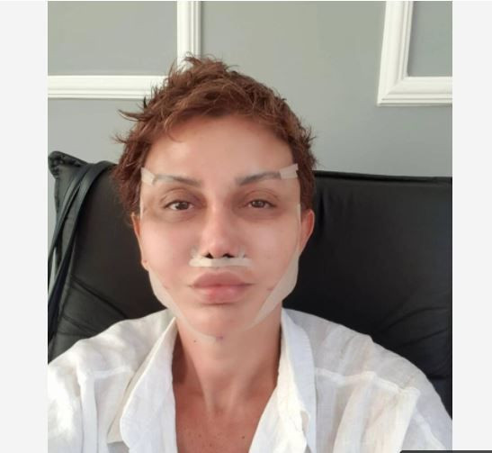 Serap Paköz estetik yaptırdı bambaşka biri oldu: Benim Seda Sayan'dan neyim eksik! - Resim: 1