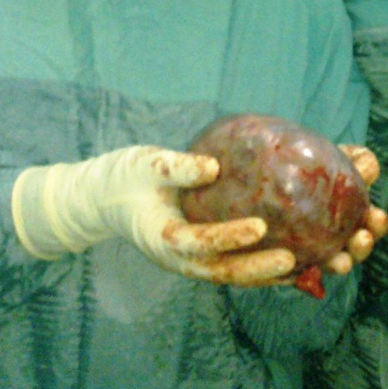 6 aylık hamile kadından çıkana bakın - Resim: 2