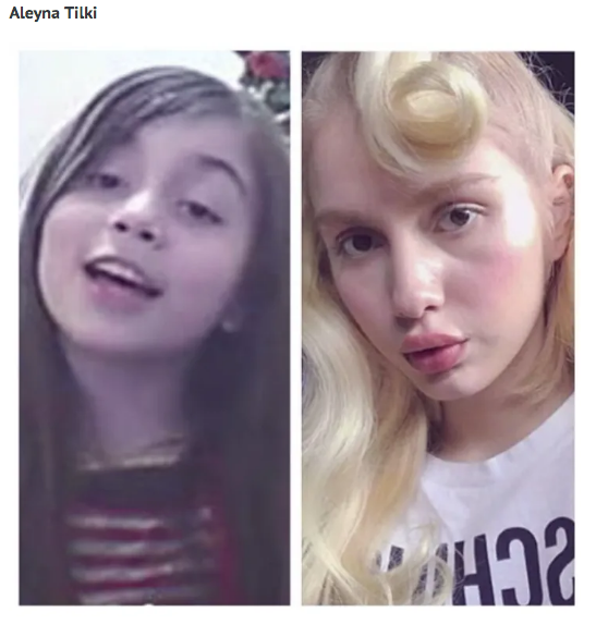 Ünlülerin eski hallerini görenler şaşkına döndü! Murat Boz'u tanıyamazsınız - Resim: 4