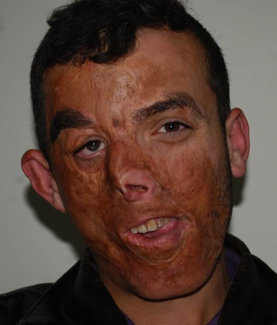 Türkiye'de bir ilk gerçekleşti - Resim: 1