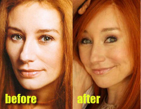 Ünlülerin estetik öncesi ve sonrası - Resim: 2