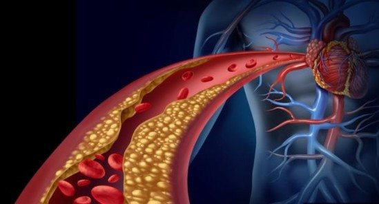 Kolestrol hastalarına müjde mucize iğne geliyor - Resim: 2