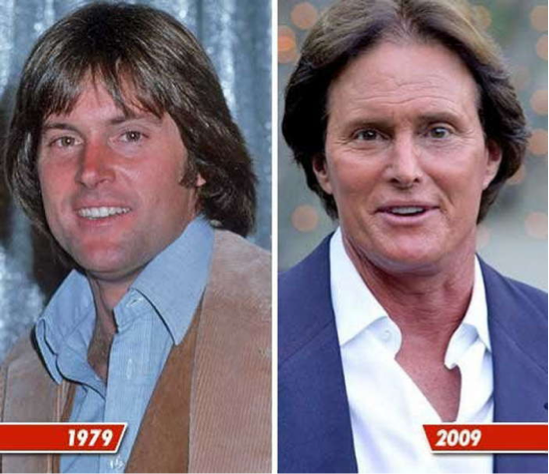 Ünlülerin estetik öncesi ve sonrası - Resim: 3