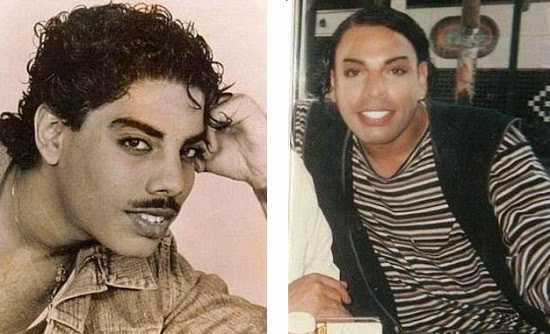 Estetik yaptırayım dedi bu hale geldi sonu ise daha beter - Resim: 2