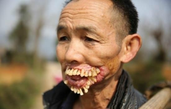 Dünyanın en garip hastalıkları - Resim: 4