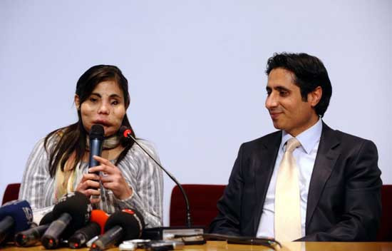 Yeni yüzüyle ilk kez kamera karşısına geçti - Resim: 3