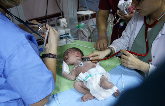 Azra bebek ve annesi Ankara'da - Resim: 4