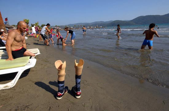 Bu bacakların bir öyküsü var - Resim: 3