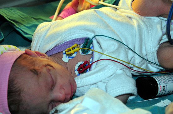 Azra bebek ve annesi Ankara'da - Resim: 1