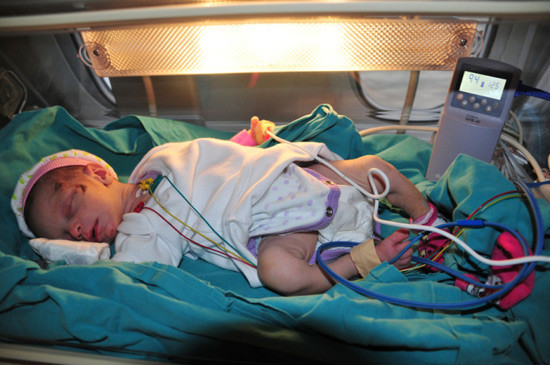 Azra bebek ve annesi Ankara'da - Resim: 2