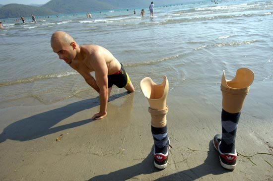 Bu bacakların bir öyküsü var - Resim: 2