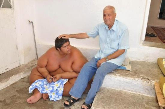 İlaç tedavisi bu hale getirdi - Resim: 2