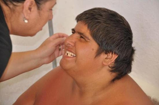 İlaç tedavisi bu hale getirdi - Resim: 3