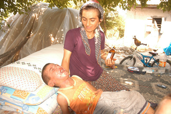 Bu çocuk 8 yıldır kaşınıyor - Resim: 2