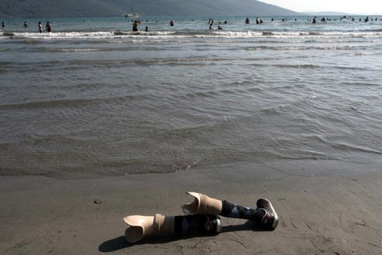 Bu bacakların bir öyküsü var - Resim: 1