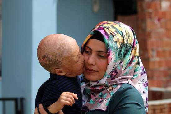 Aydın'da yaşayan Halil Geyik'in ameliyatı için gerekli para toplandı - Resim: 3