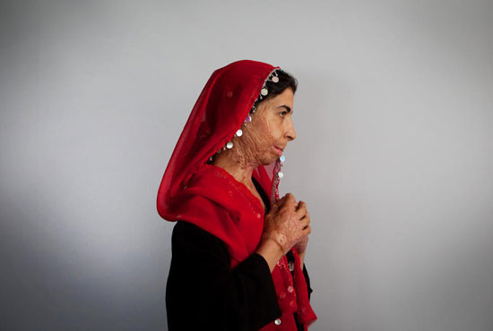 Afgan kadınları intiharın eşiğinde! - Resim: 1