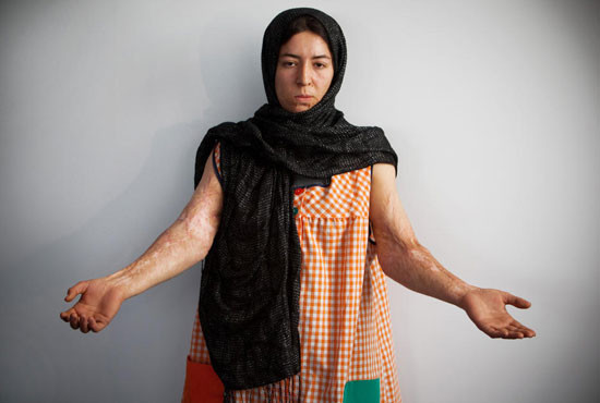 Afgan kadınları intiharın eşiğinde! - Resim: 3