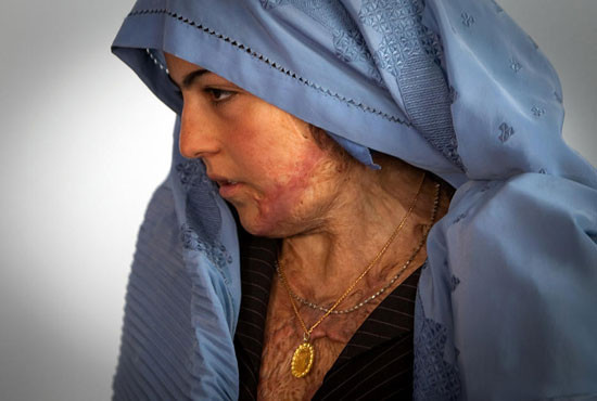 Afgan kadınları intiharın eşiğinde! - Resim: 4