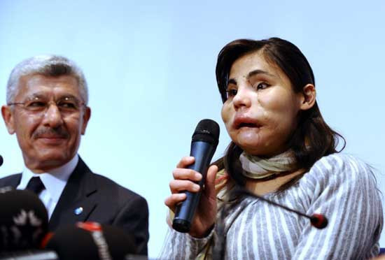 Yeni yüzüyle ilk kez kamera karşısına geçti - Resim: 4