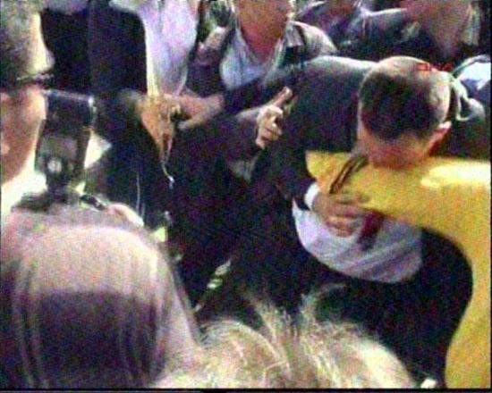 Bakan Yıldız'a yumruklu saldırı - Resim: 2