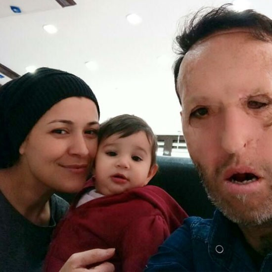 Recep Sert perişan halde eşi Esma anlattı 'ne yapacağız' - Resim: 2