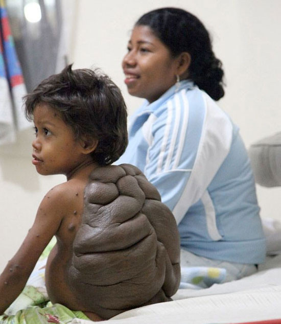 Kaplumbağa çocuk görenleri şok etti - Resim: 1