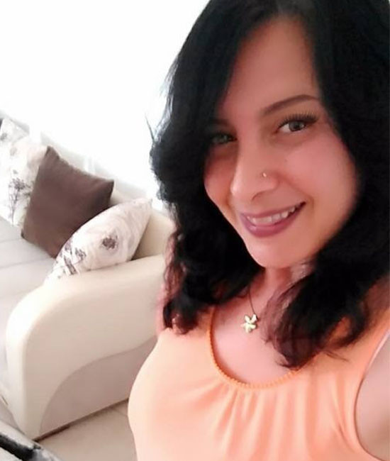 Dişlerini beyazlatmak istedi ancak 32 dişinden oldu şimdi ise... - Resim: 3