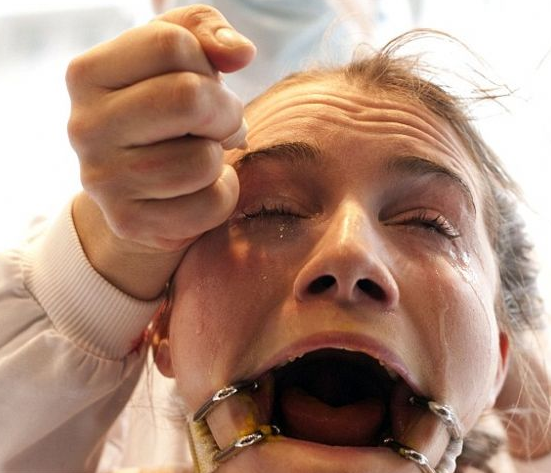 Hayvan yerine geçti, inanılmaz acı çekti! - Resim: 2