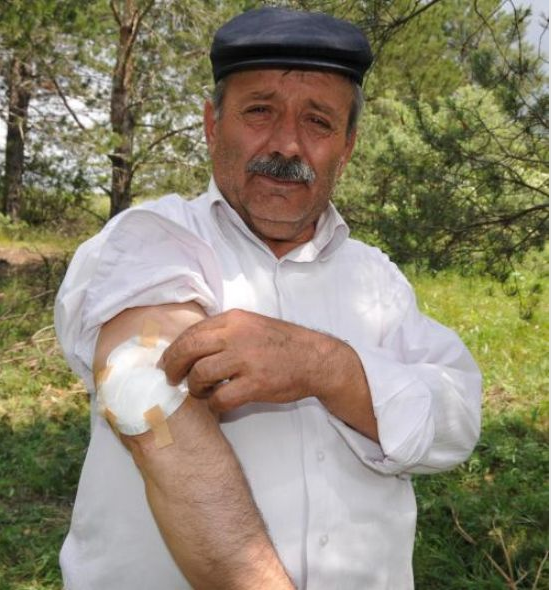 15 yıl kolundaki bezle yaşadı - Resim: 4