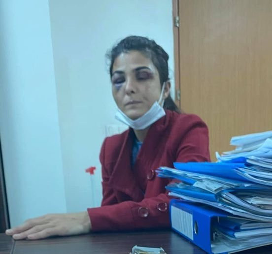 Türkiye'nin konuştuğu Melek İpek'ten haber var! "Kötü günler geride kaldı ileriye bakmak zorundayım" - Resim: 0