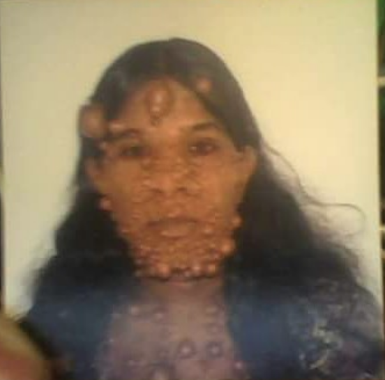 Görenler korkup kaçıyor canavar diye sesleniyorlar - Resim: 1