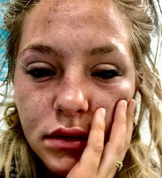 Gece kulübünün tuvaletinde baygın halde bulundu başına gelenler korkunç! - Resim: 2