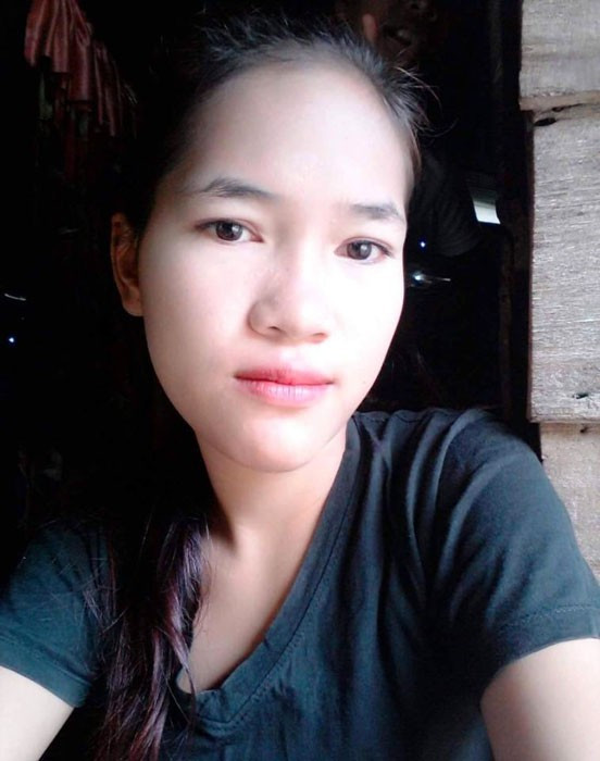 Diş çektirmeye gitti şimdi yüzünün yarısı yok! - Resim: 3