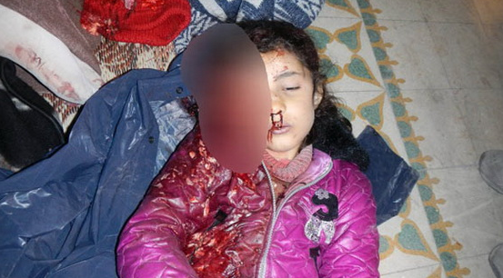 Suriye'deki katliamın en acı fotoğrafları - Resim: 3