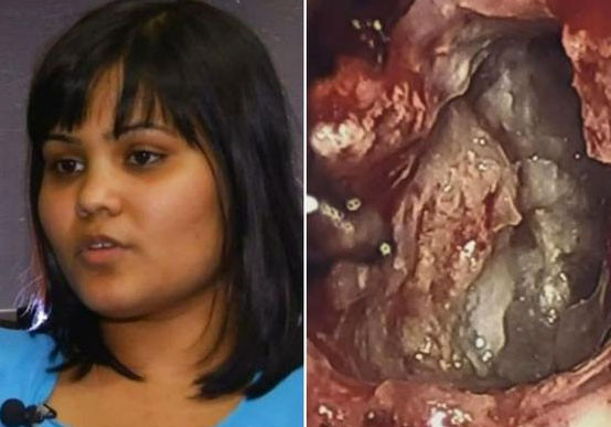 İkizi beyninde büyüdü - Resim: 3