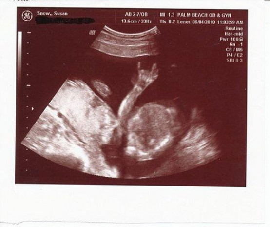 Ultrasonda gördüler dehşete düştüler doktor odadan kaçtı - Resim: 1