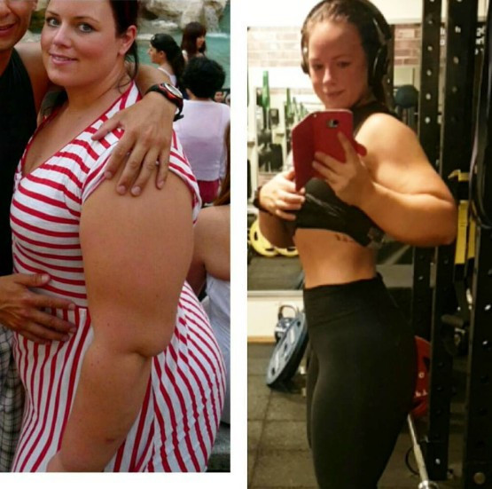 Bir anda 80 kilo verdi inanılmaz değişim - Resim: 2