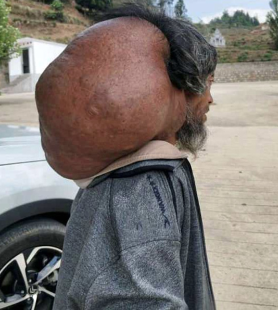 Boynunu görenler korkup kaçıyordu tam 15 kilo! - Resim: 2