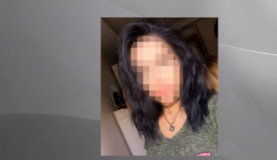 Göz rengi değiştirme ameliyatı az daha kör ediyordu - Resim: 1