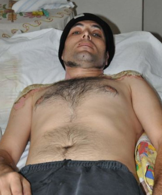 Cezaevinde korkunç işkence! - Resim: 1