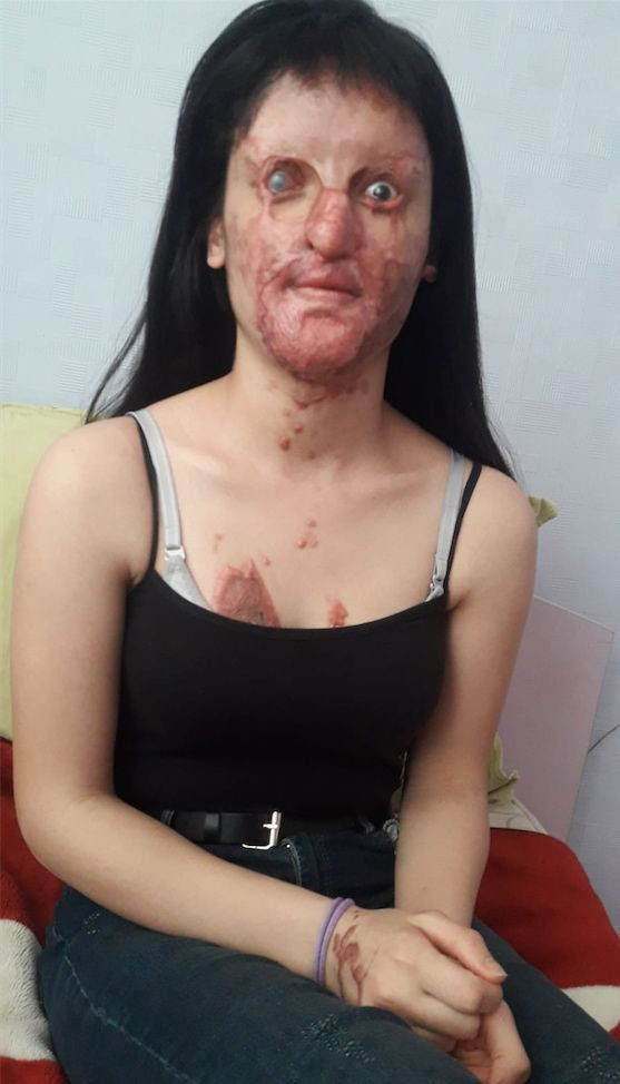 Berfin Özek tanınmaz hale geldi babası ilk kez konuştu - Resim: 1